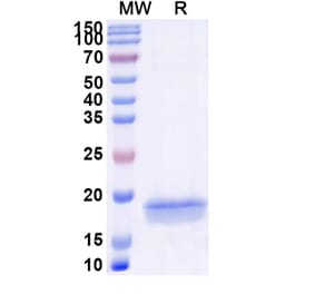 SDS-PAGE - Anti-Notch1 Nanobody [SAA1286] (A337908) - Antibodies.com