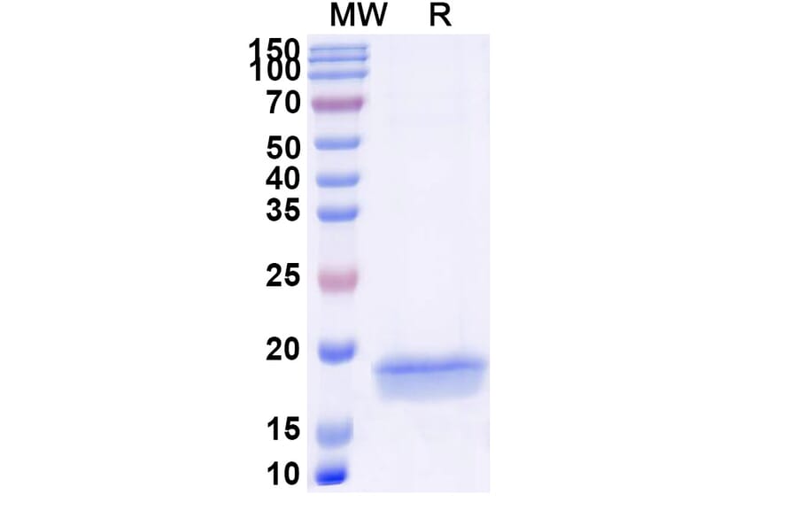 SDS-PAGE - Anti-Notch1 Nanobody [SAA1286] (A337908) - Antibodies.com
