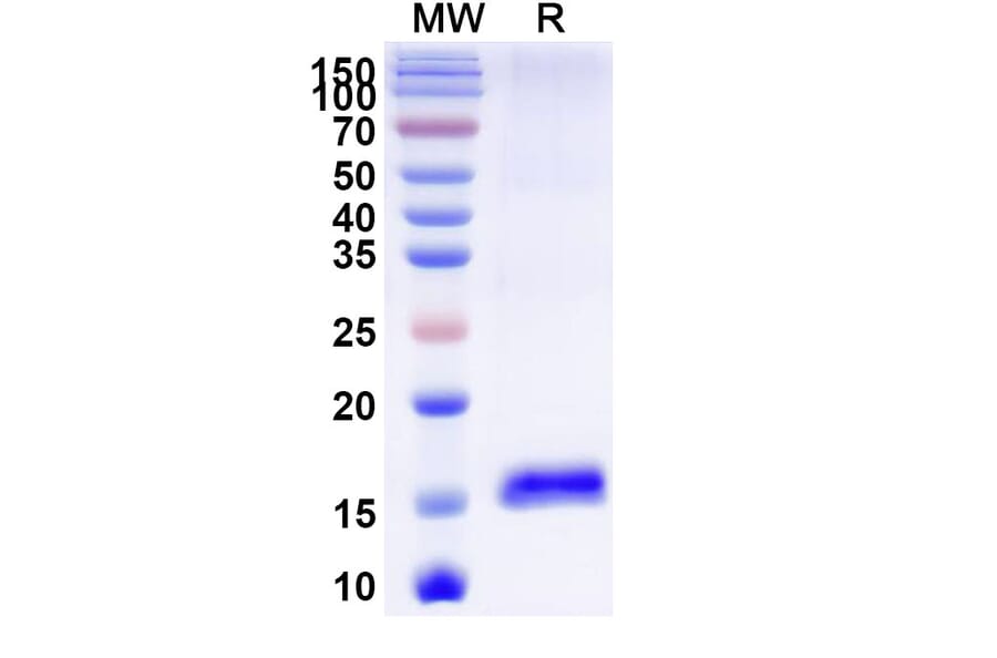 SDS-PAGE - Anti-CCT5 Nanobody [SAA1374] (A337910) - Antibodies.com