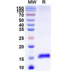 SDS-PAGE - Anti-CCT5 Nanobody [SAA1374] (A337910) - Antibodies.com