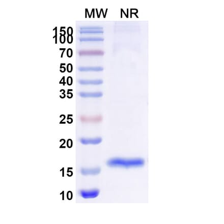 SDS-PAGE - Anti-TUFM Nanobody [SAA1227] (A337911) - Antibodies.com