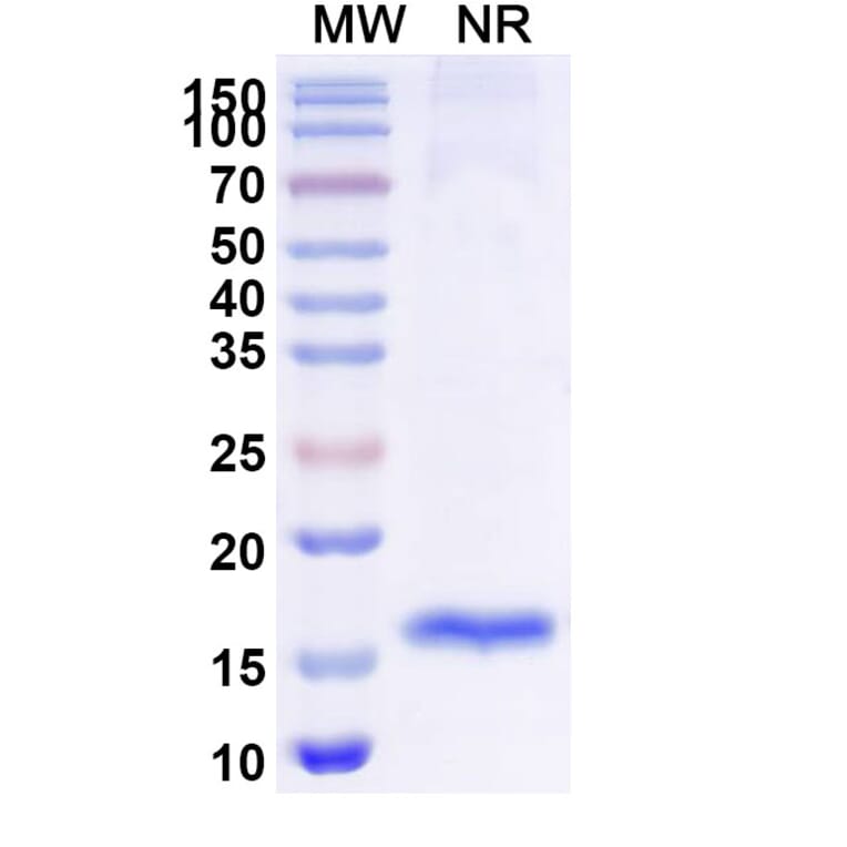 SDS-PAGE - Anti-TUFM Nanobody [SAA1227] (A337911) - Antibodies.com