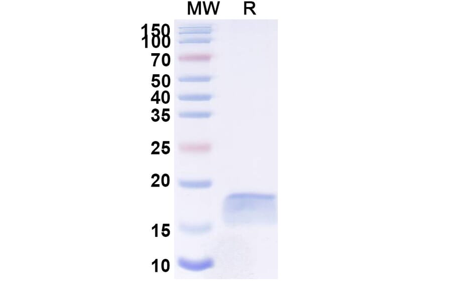 SDS-PAGE - Anti-PLGF Nanobody [SAA1244] (A337912) - Antibodies.com