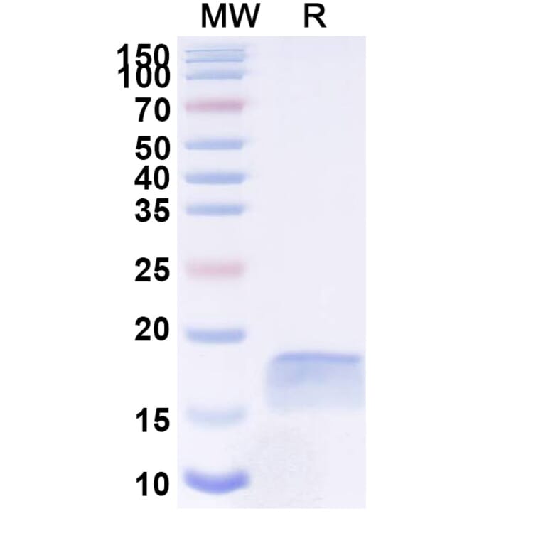 SDS-PAGE - Anti-PLGF Nanobody [SAA1244] (A337912) - Antibodies.com