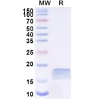 SDS-PAGE - Anti-PLGF Nanobody [SAA1244] (A337912) - Antibodies.com