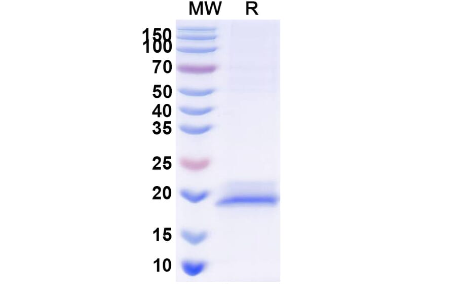 SDS-PAGE - Anti-Glypican 3 Nanobody [SAA1340] (A337913) - Antibodies.com