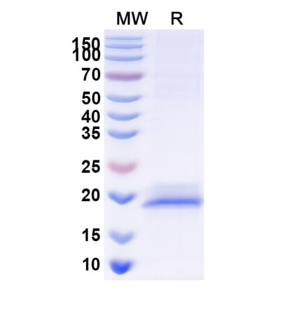 SDS-PAGE - Anti-Glypican 3 Nanobody [SAA1340] (A337913) - Antibodies.com