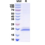SDS-PAGE - Anti-Glypican 3 Nanobody [SAA1340] (A337913) - Antibodies.com
