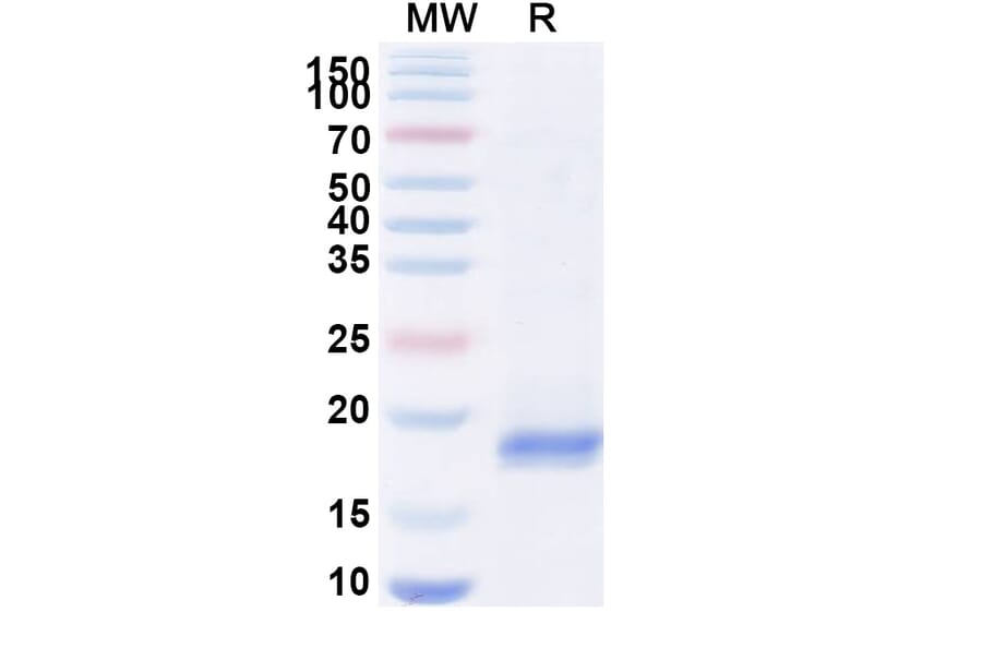 SDS-PAGE - Anti-BLM Nanobody [SAA0979] (A337915) - Antibodies.com