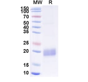 SDS-PAGE - Anti-beta Actin Nanobody [SAA1234] (A337919) - Antibodies.com