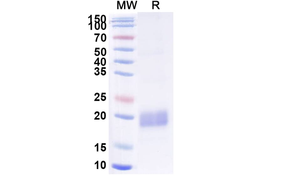 SDS-PAGE - Anti-beta Actin Nanobody [SAA1234] (A337919) - Antibodies.com
