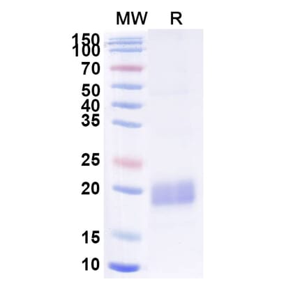 SDS-PAGE - Anti-beta Actin Nanobody [SAA1234] (A337919) - Antibodies.com