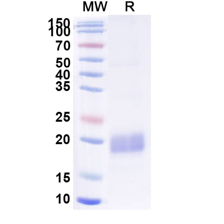 SDS-PAGE - Anti-beta Actin Nanobody [SAA1234] (A337919) - Antibodies.com