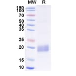 SDS-PAGE - Anti-beta Actin Nanobody [SAA1234] (A337919) - Antibodies.com