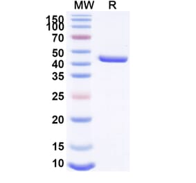 SDS-PAGE - Anti-Lysozyme Nanobody [SAA1157] (A337921) - Antibodies.com
