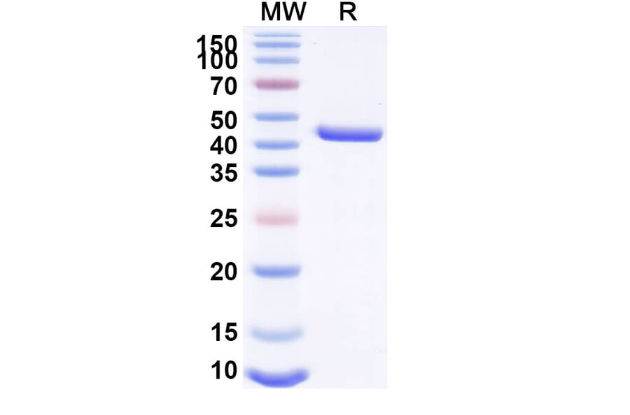 SDS-PAGE - Anti-Lysozyme Nanobody [SAA1157] (A337921) - Antibodies.com