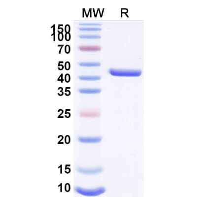 SDS-PAGE - Anti-Lysozyme Nanobody [SAA1157] (A337921) - Antibodies.com
