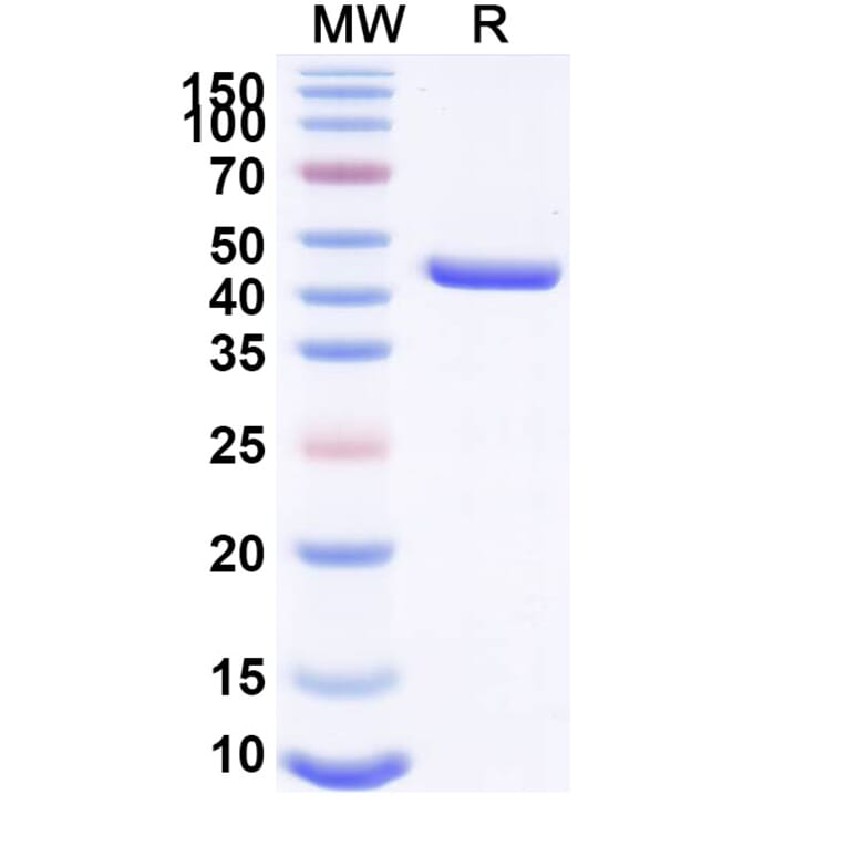 SDS-PAGE - Anti-Lysozyme Nanobody [SAA1157] (A337921) - Antibodies.com