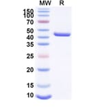 SDS-PAGE - Anti-Lysozyme Nanobody [SAA1157] (A337921) - Antibodies.com