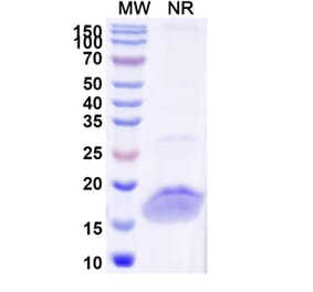 SDS-PAGE - Anti-Lysozyme Nanobody [SAA1052] (A337922) - Antibodies.com