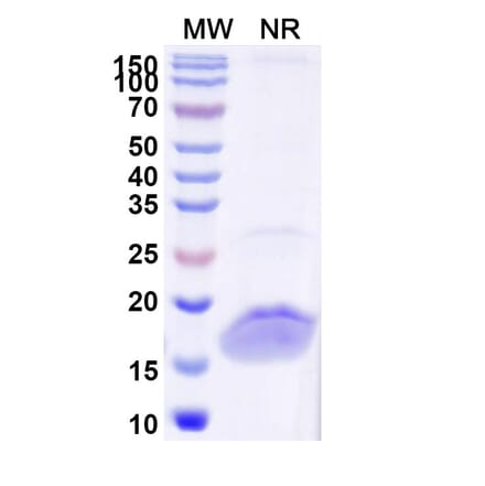 SDS-PAGE - Anti-Lysozyme Nanobody [SAA1052] (A337922) - Antibodies.com