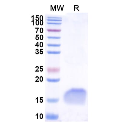 SDS-PAGE - Anti-Lysozyme Nanobody [SAA1053] (A337923) - Antibodies.com