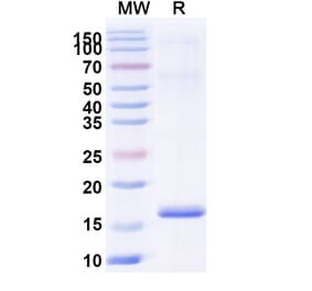 SDS-PAGE - Anti-Lysozyme Nanobody [SAA1112] (A337924) - Antibodies.com