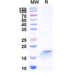 SDS-PAGE - Anti-beta 2 Microglobulin Nanobody [SAA1047] (A337925) - Antibodies.com