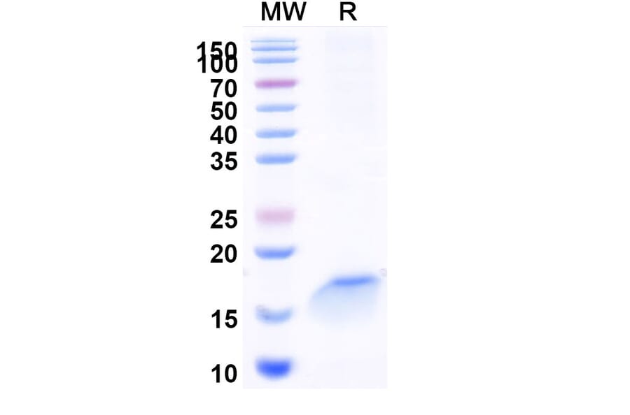 SDS-PAGE - Anti-beta 2 Microglobulin Nanobody [SAA1047] (A337925) - Antibodies.com