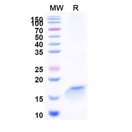 SDS-PAGE - Anti-beta 2 Microglobulin Nanobody [SAA1047] (A337925) - Antibodies.com