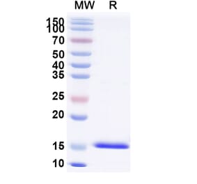 SDS-PAGE - Anti-RhoB Nanobody [SAA1319] (A337926) - Antibodies.com