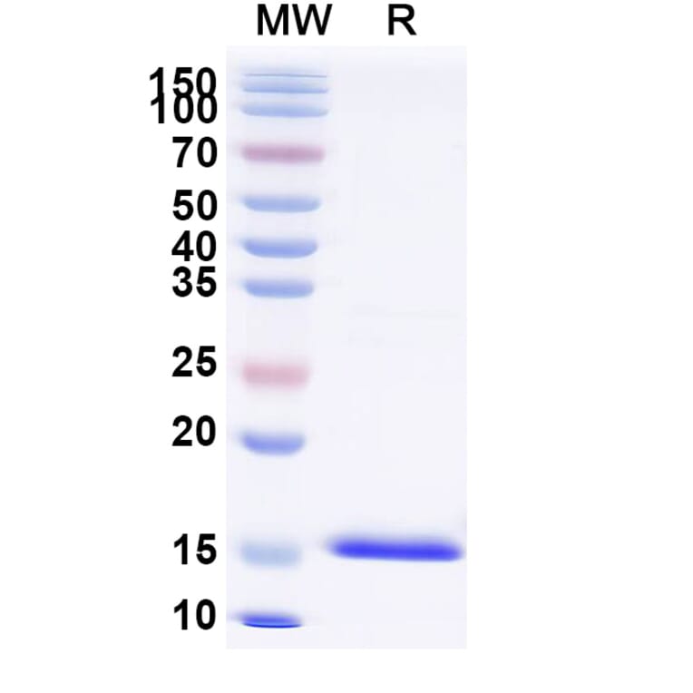 SDS-PAGE - Anti-RhoB Nanobody [SAA1319] (A337926) - Antibodies.com