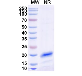 SDS-PAGE - Anti-RhoB Nanobody [SAA0880] (A337927) - Antibodies.com