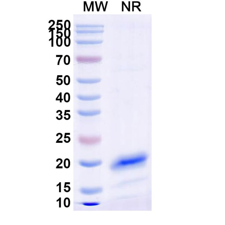 SDS-PAGE - Anti-RhoB Nanobody [SAA0880] (A337927) - Antibodies.com