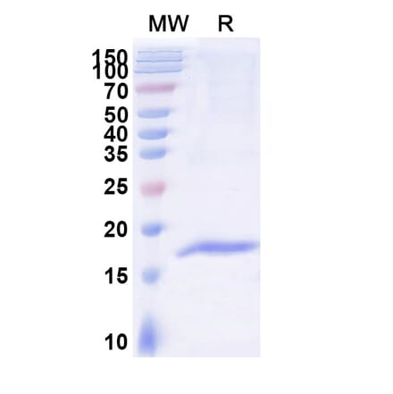 SDS-PAGE - Anti-ADAM8 Nanobody [SAA1215] (A337929) - Antibodies.com