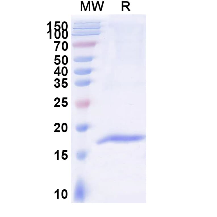 SDS-PAGE - Anti-ADAM8 Nanobody [SAA1215] (A337929) - Antibodies.com