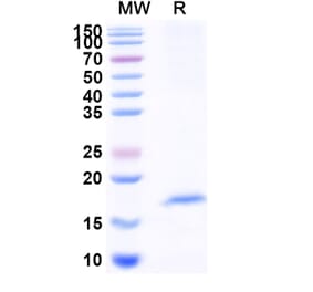 SDS-PAGE - Anti-OLR1 Nanobody [SAA1291] (A337931) - Antibodies.com