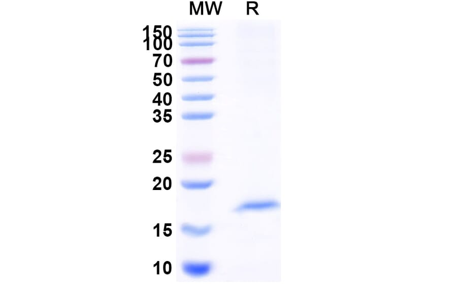 SDS-PAGE - Anti-OLR1 Nanobody [SAA1291] (A337931) - Antibodies.com