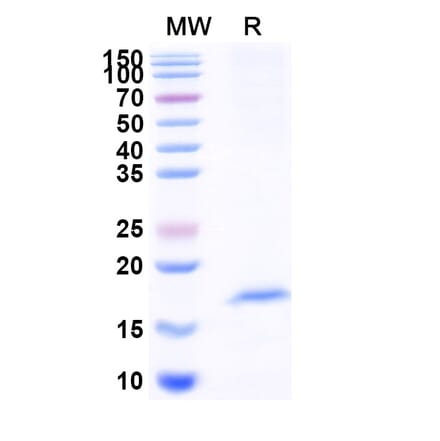 SDS-PAGE - Anti-OLR1 Nanobody [SAA1291] (A337931) - Antibodies.com