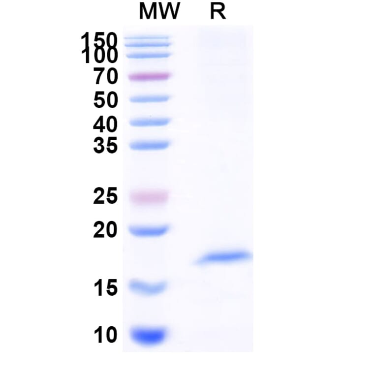 SDS-PAGE - Anti-OLR1 Nanobody [SAA1291] (A337931) - Antibodies.com
