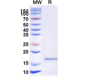 SDS-PAGE - Anti-Jagged1 Nanobody [SAA1285] (A337932) - Antibodies.com