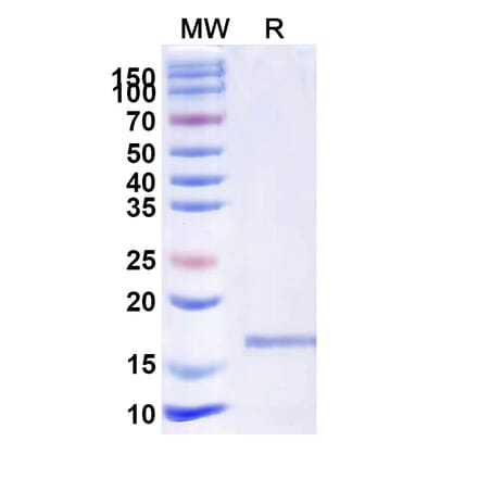 SDS-PAGE - Anti-Jagged1 Nanobody [SAA1285] (A337932) - Antibodies.com