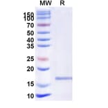 SDS-PAGE - Anti-Jagged1 Nanobody [SAA1285] (A337932) - Antibodies.com