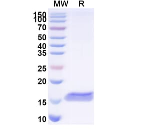 SDS-PAGE - Anti-PTH1R Nanobody [SAA1275] (A337936) - Antibodies.com