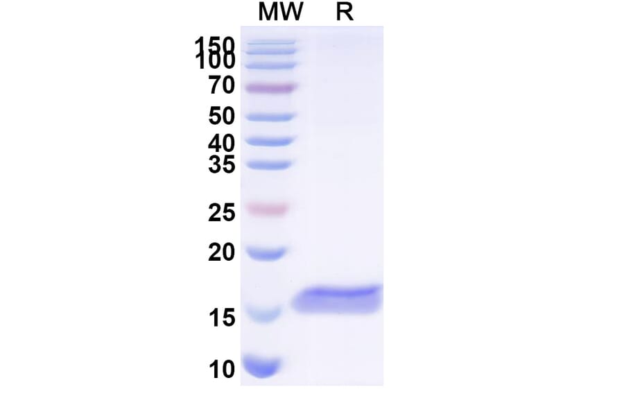 SDS-PAGE - Anti-PTH1R Nanobody [SAA1275] (A337936) - Antibodies.com