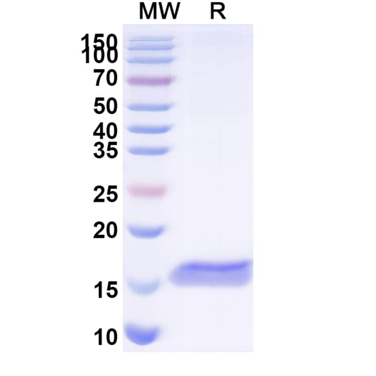 SDS-PAGE - Anti-PTH1R Nanobody [SAA1275] (A337936) - Antibodies.com