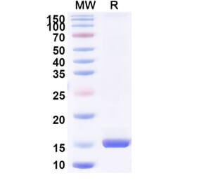 SDS-PAGE - Anti-Bax Nanobody [SAA1222] (A337941) - Antibodies.com