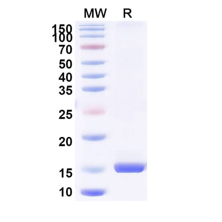 SDS-PAGE - Anti-Bax Nanobody [SAA1222] (A337941) - Antibodies.com
