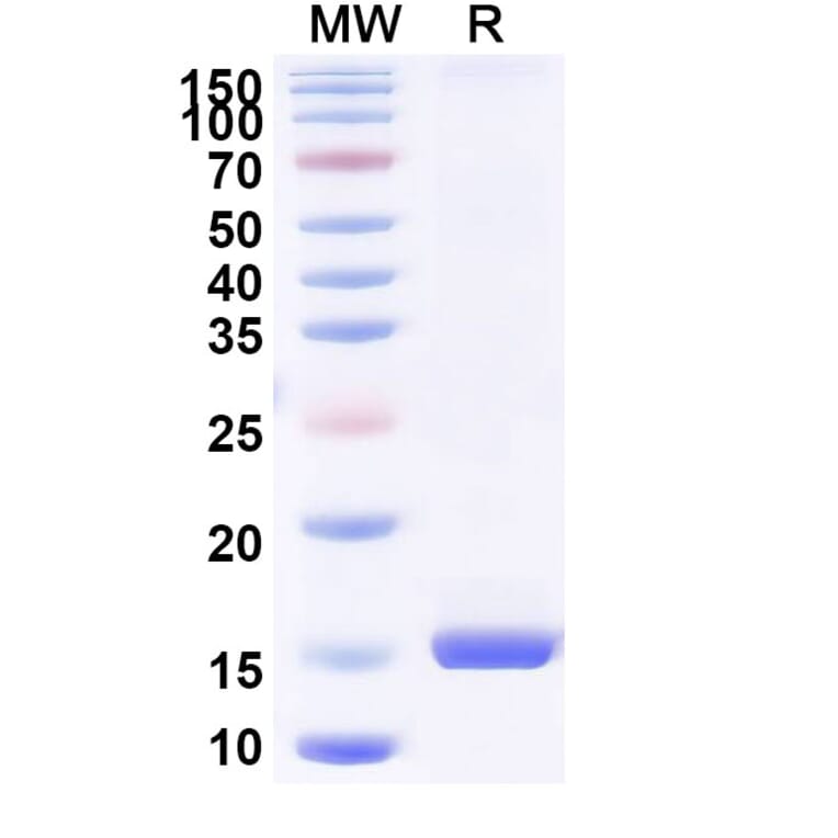 SDS-PAGE - Anti-Bax Nanobody [SAA1222] (A337941) - Antibodies.com