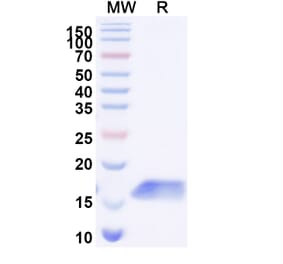 SDS-PAGE - Anti-Cadherin-17 Nanobody [SAA1325] (A337943) - Antibodies.com